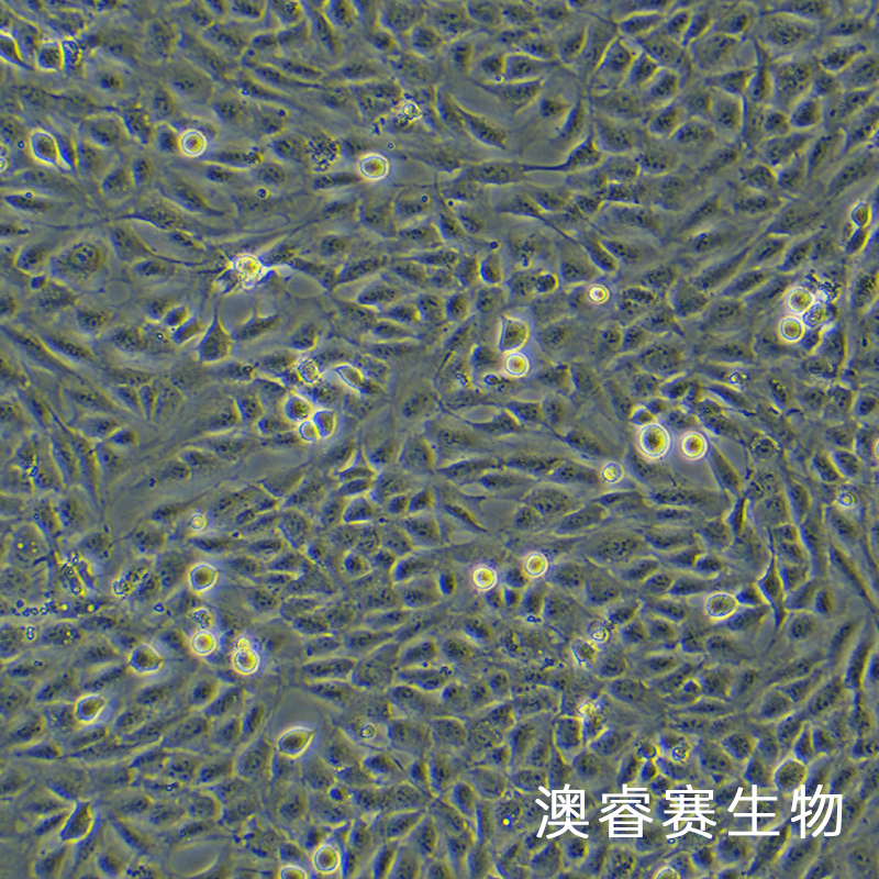 HCMEC/D3（永生化脑微血管内皮细胞）