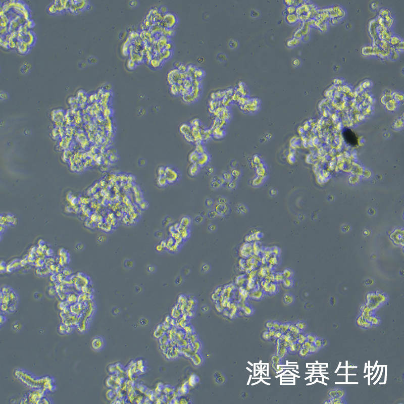 Y79（人视网膜母细胞瘤）