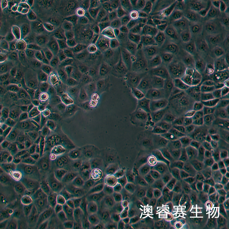 NIH:OVCAR-3 [OVCAR3]（人卵巢癌细胞）