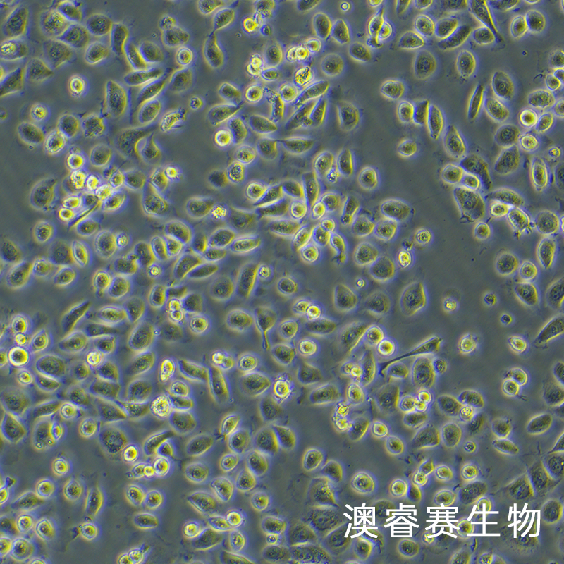 人子宫内膜上皮细胞永生化
