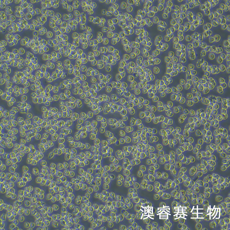 Nalm-6（人B淋巴白血病细胞）