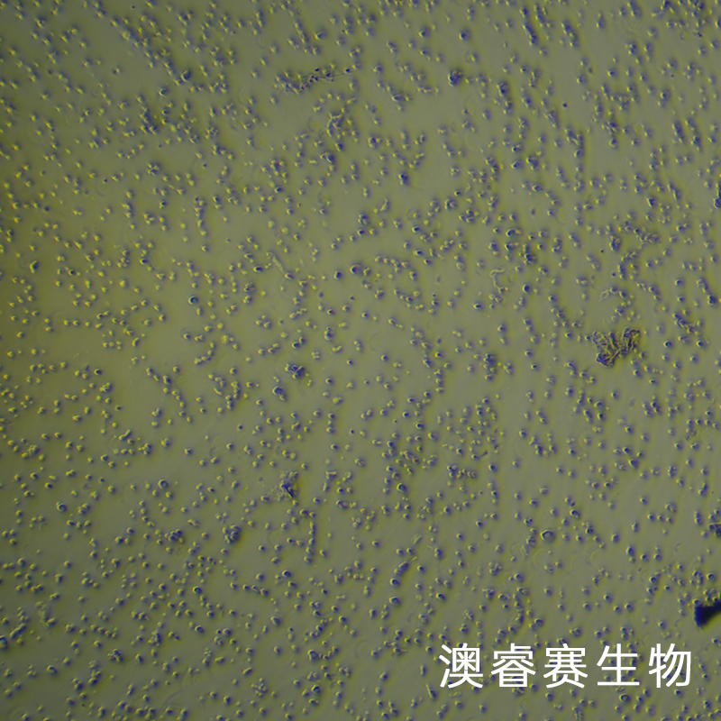 Nalm-6（人B淋巴白血病细胞）