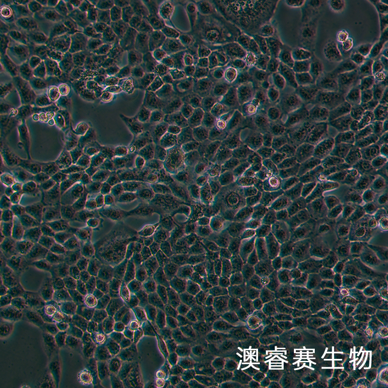 NPC/HK-1（人鼻咽癌细胞）