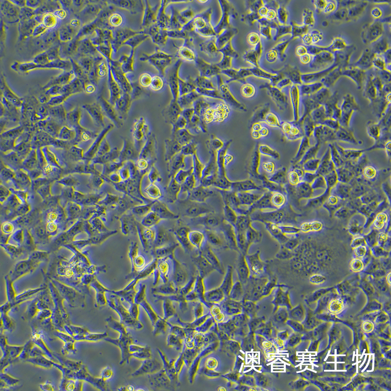 HTR-8/Svneo（人绒毛膜滋养细胞）
