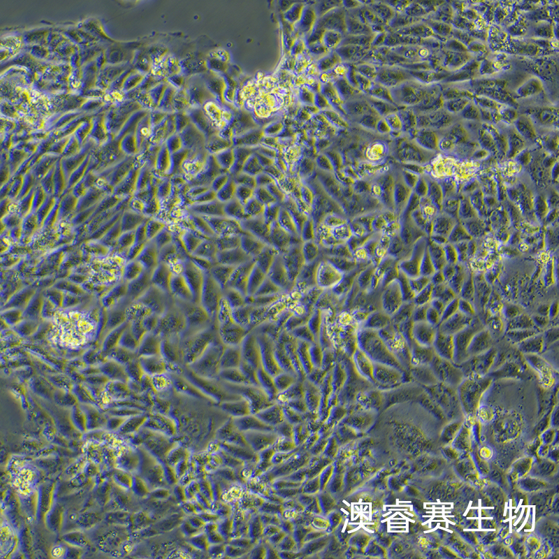 CMT93（小鼠结肠癌细胞）