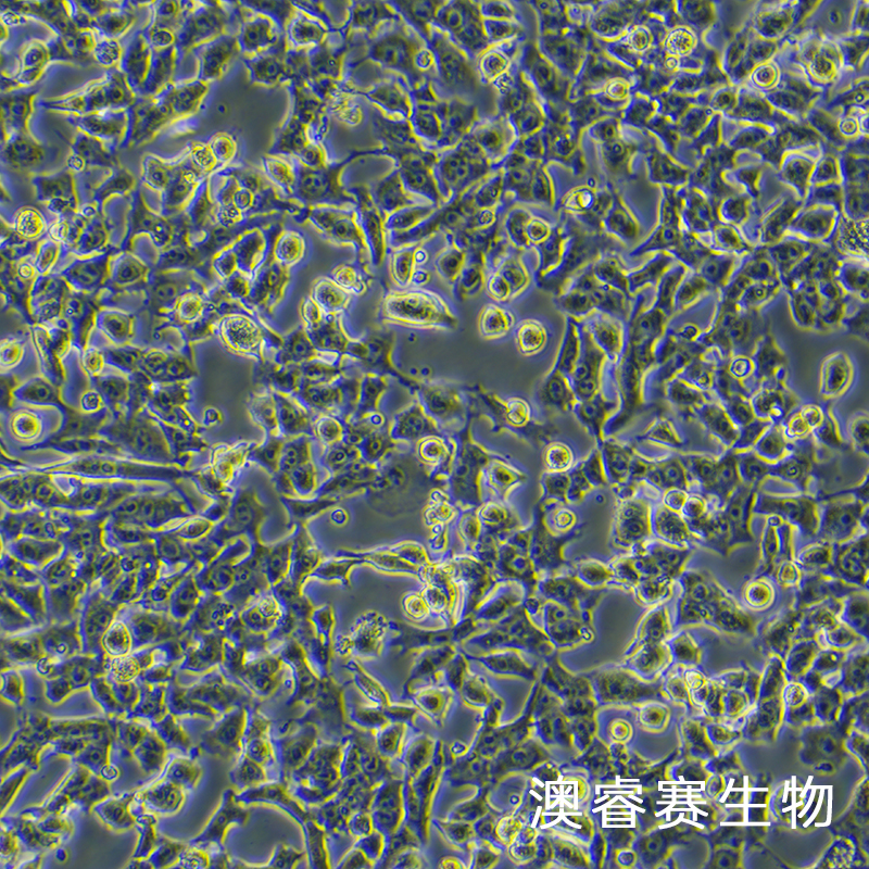 HEPA1-6-LUC（萤火虫荧光素酶标记的小鼠肝癌细胞）