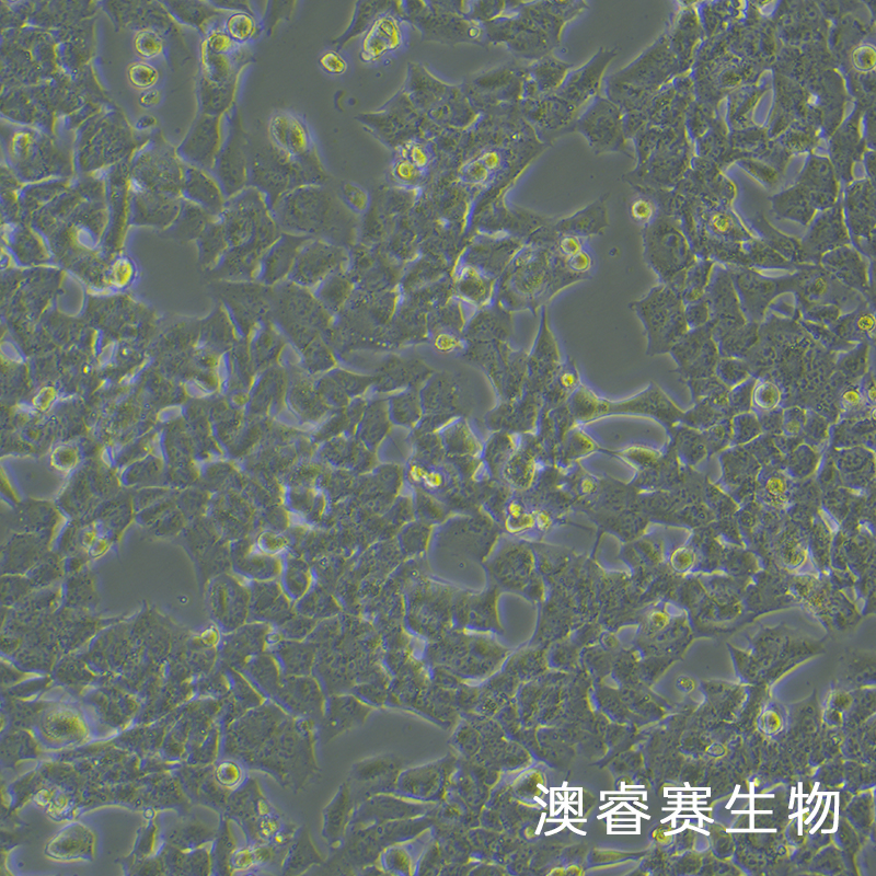 GL261-LUC（小鼠胶质瘤细胞带荧光素酶）