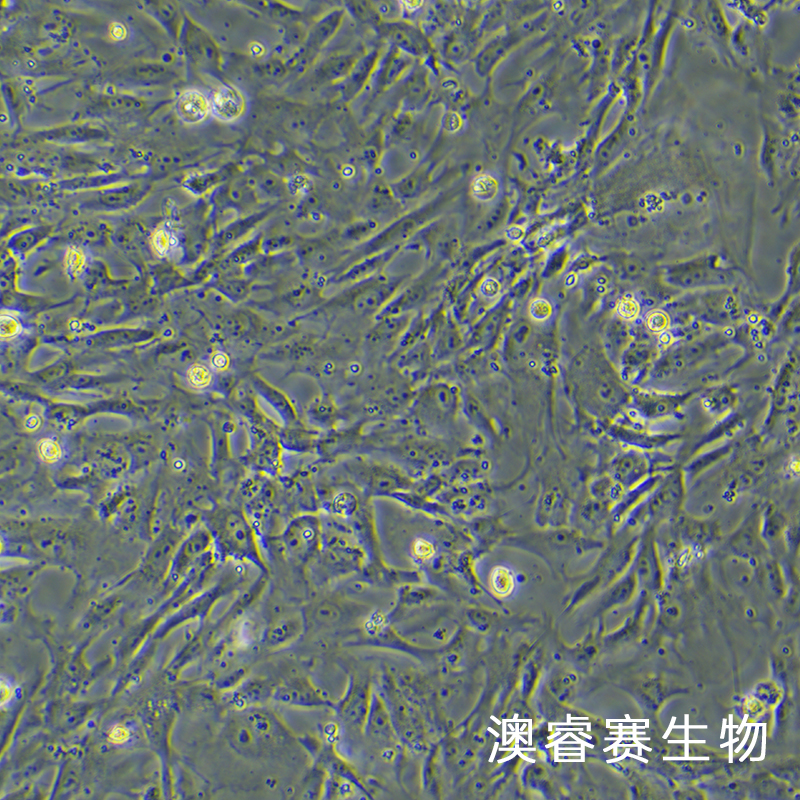 sNF96.2（人雪旺细胞神经纤维瘤病1型）