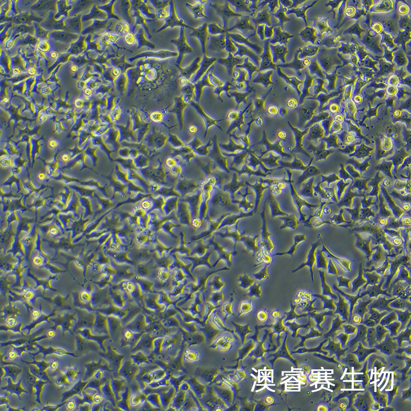 LMH（鸡肝癌细胞）