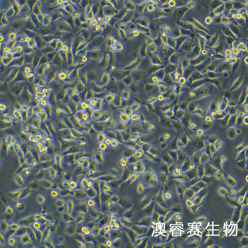 HMRSV5（人腹膜间皮细胞）