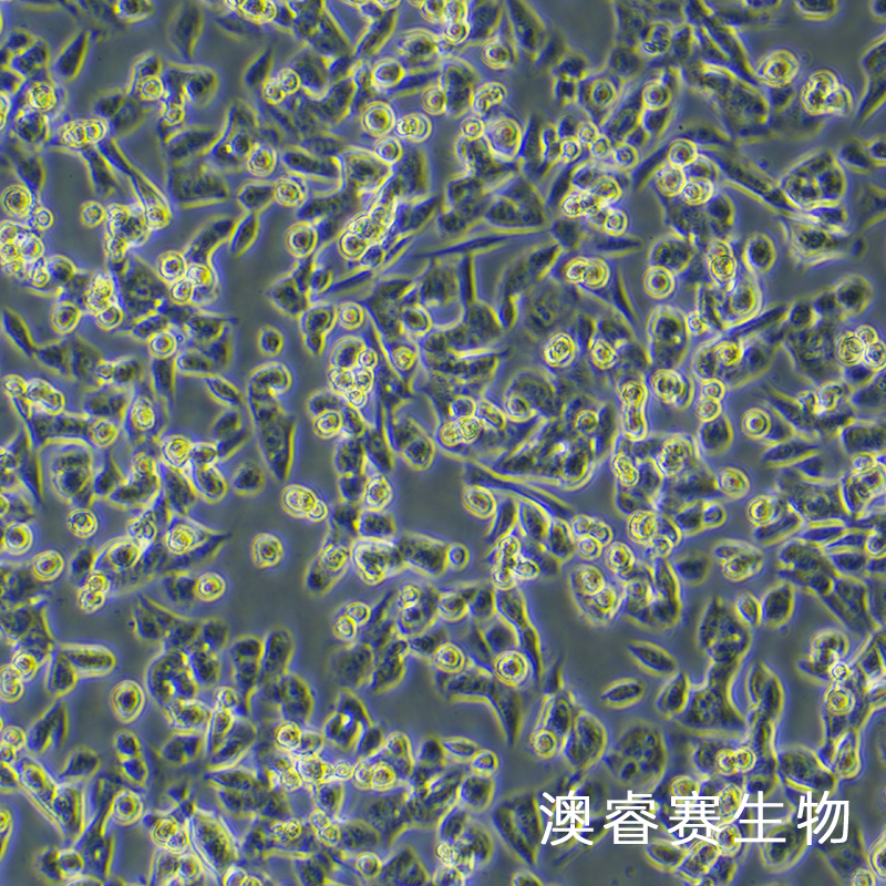 MCA-205（小鼠纤维肉瘤细胞）