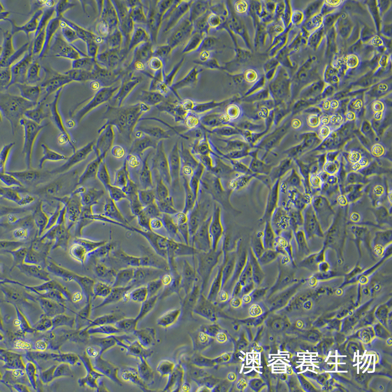 T/G HAVSMC（人血管平滑肌细胞）