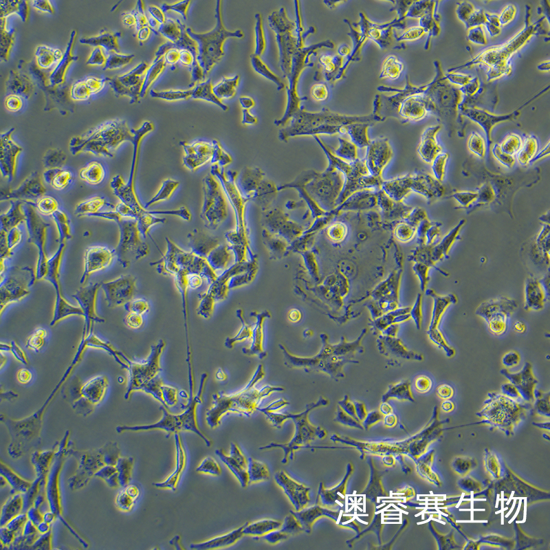 PC-12低分化（大鼠肾上腺嗜铬细胞瘤细胞（低分化））