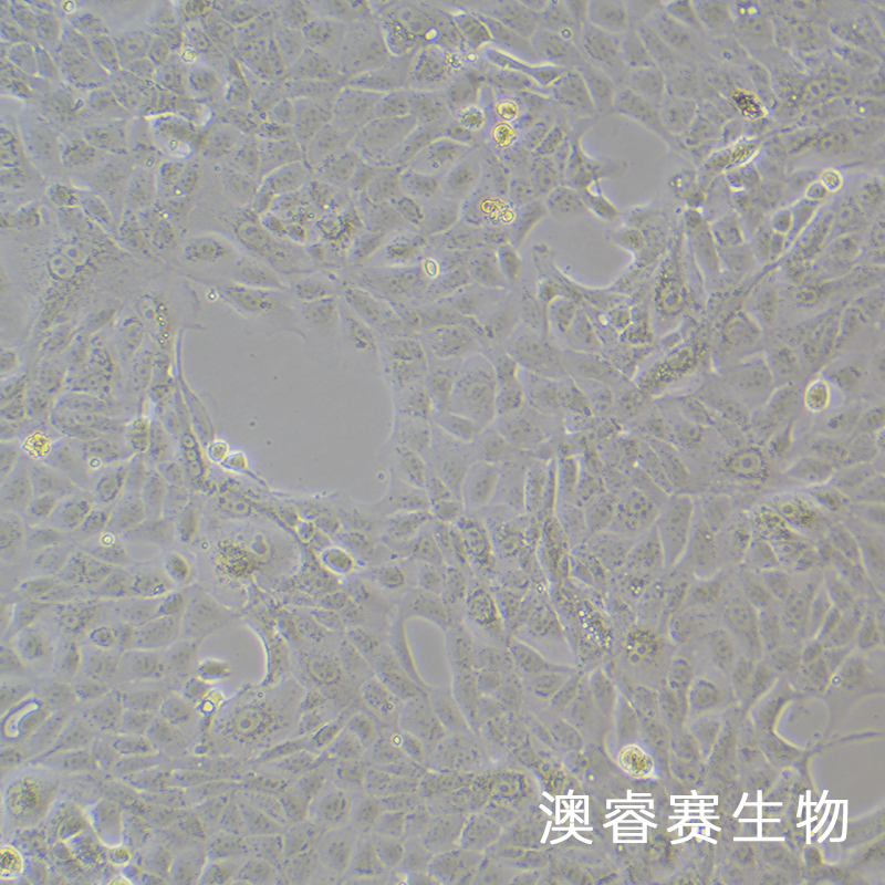 MDCK [NBL-2]（犬肾细胞）