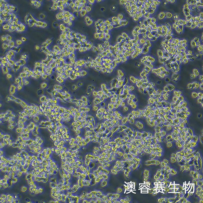 LoVo（人结肠癌细胞）