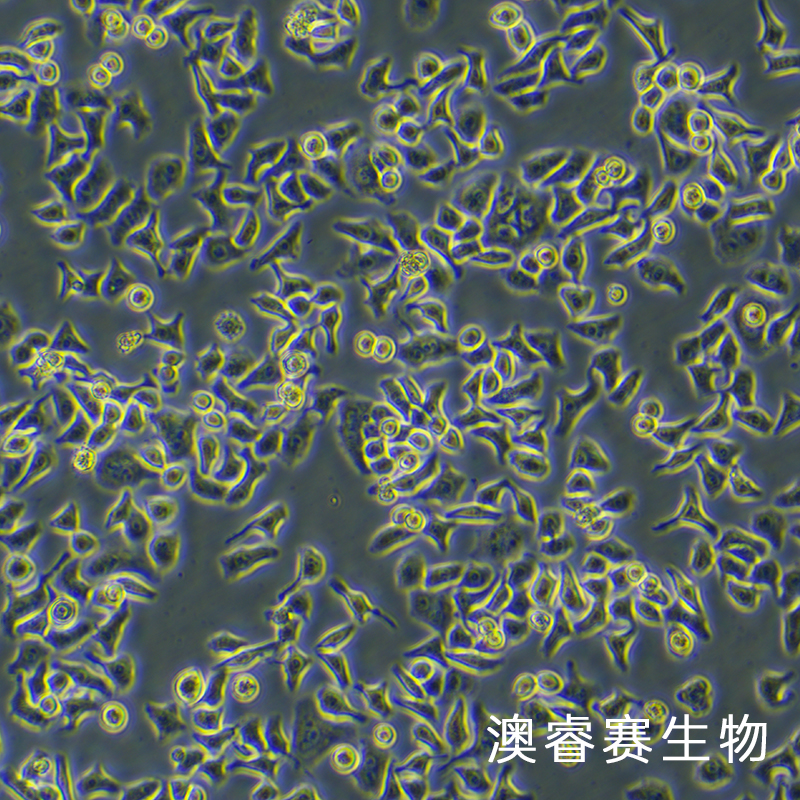 HCCLM3（高转移人肝癌细胞）