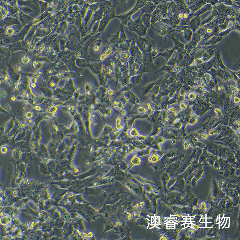 GL261（小鼠胶质瘤细胞）