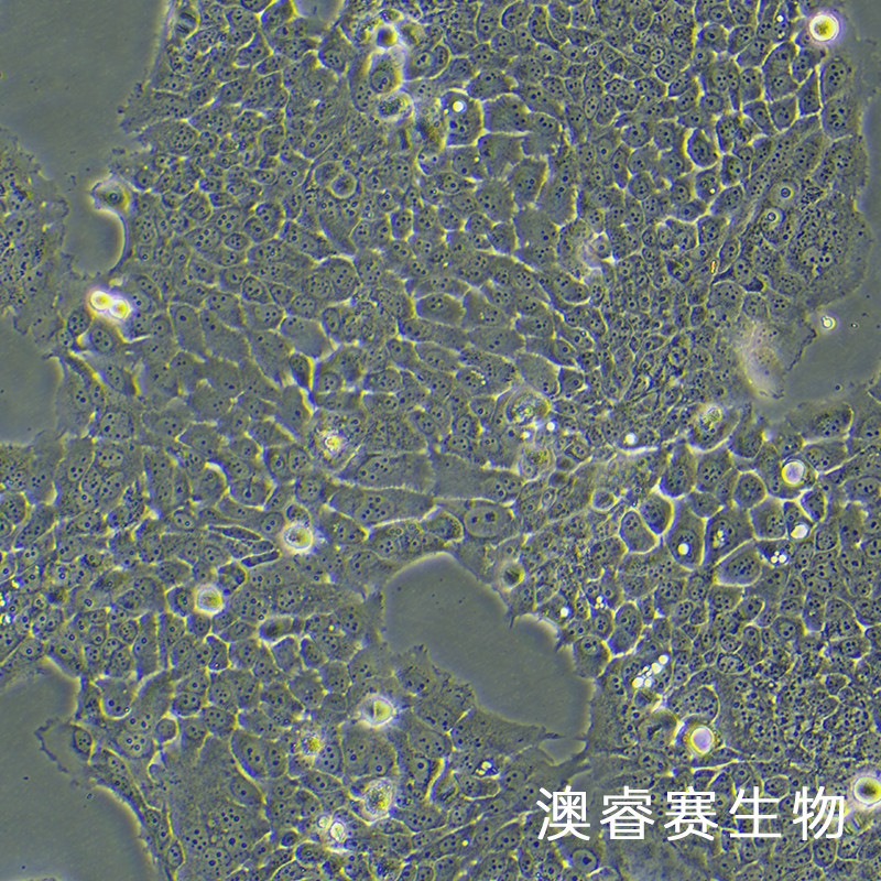 ZR-75-30（人乳腺癌细胞）