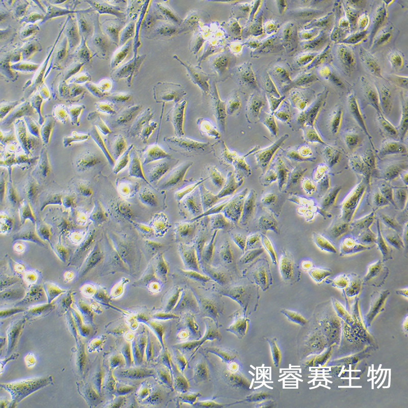 MDA-MB-231-luc（人乳腺癌细胞-荧光素酶标记）