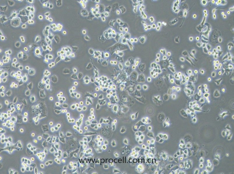 Neuro-2a 细胞[N2a; Neuro-2a细胞] (小鼠脑神经瘤细胞) (STR鉴定正确)CL-0168