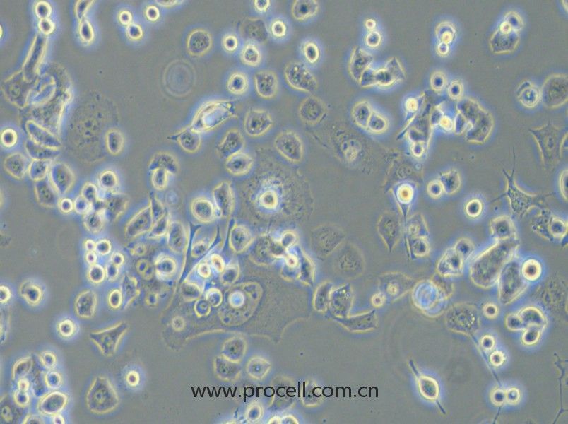 Neuro-2a 细胞[N2a; Neuro-2a细胞] (小鼠脑神经瘤细胞) (STR鉴定正确)CL-0168