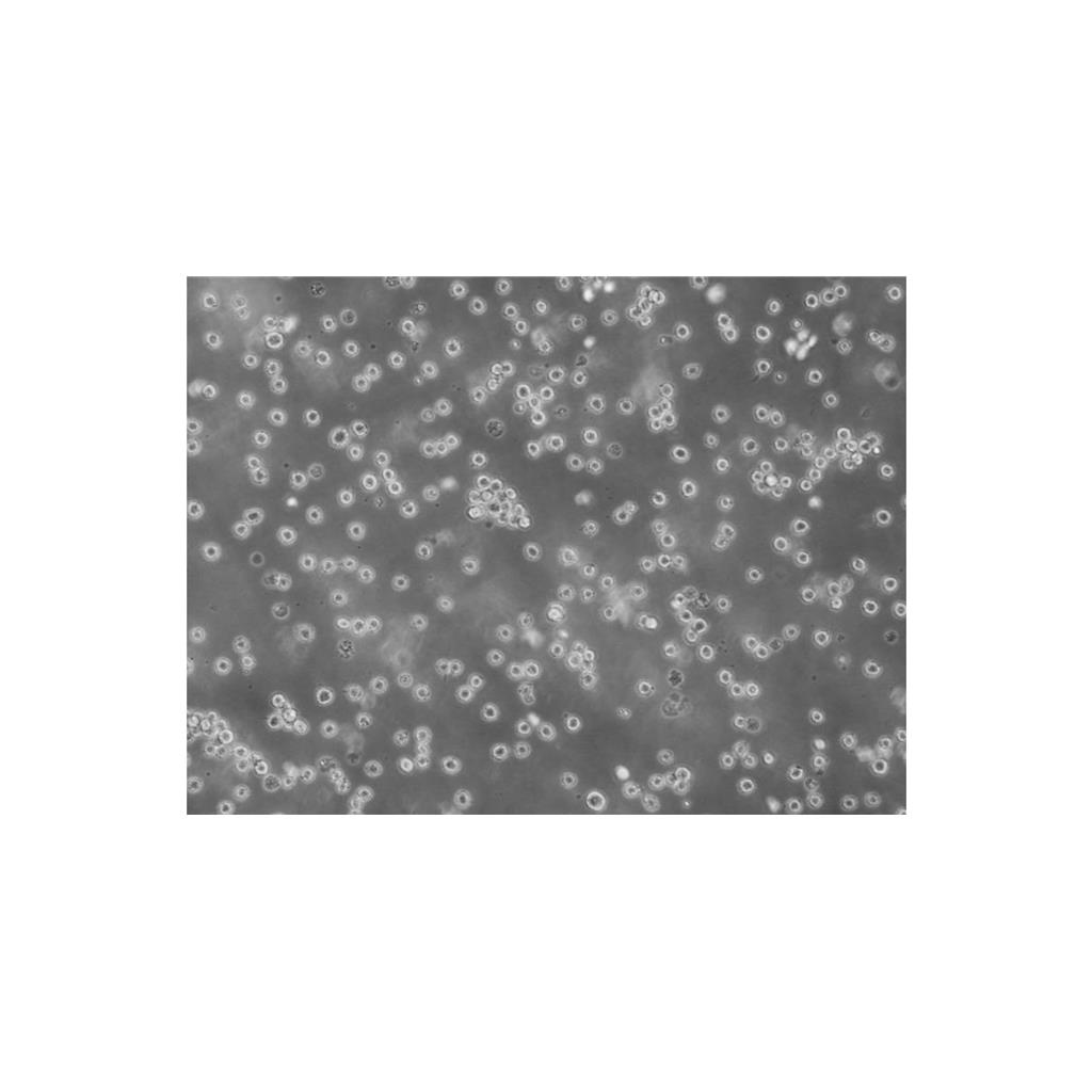 U14 Cells小鼠子宫颈癌细胞专业保种|STR图谱