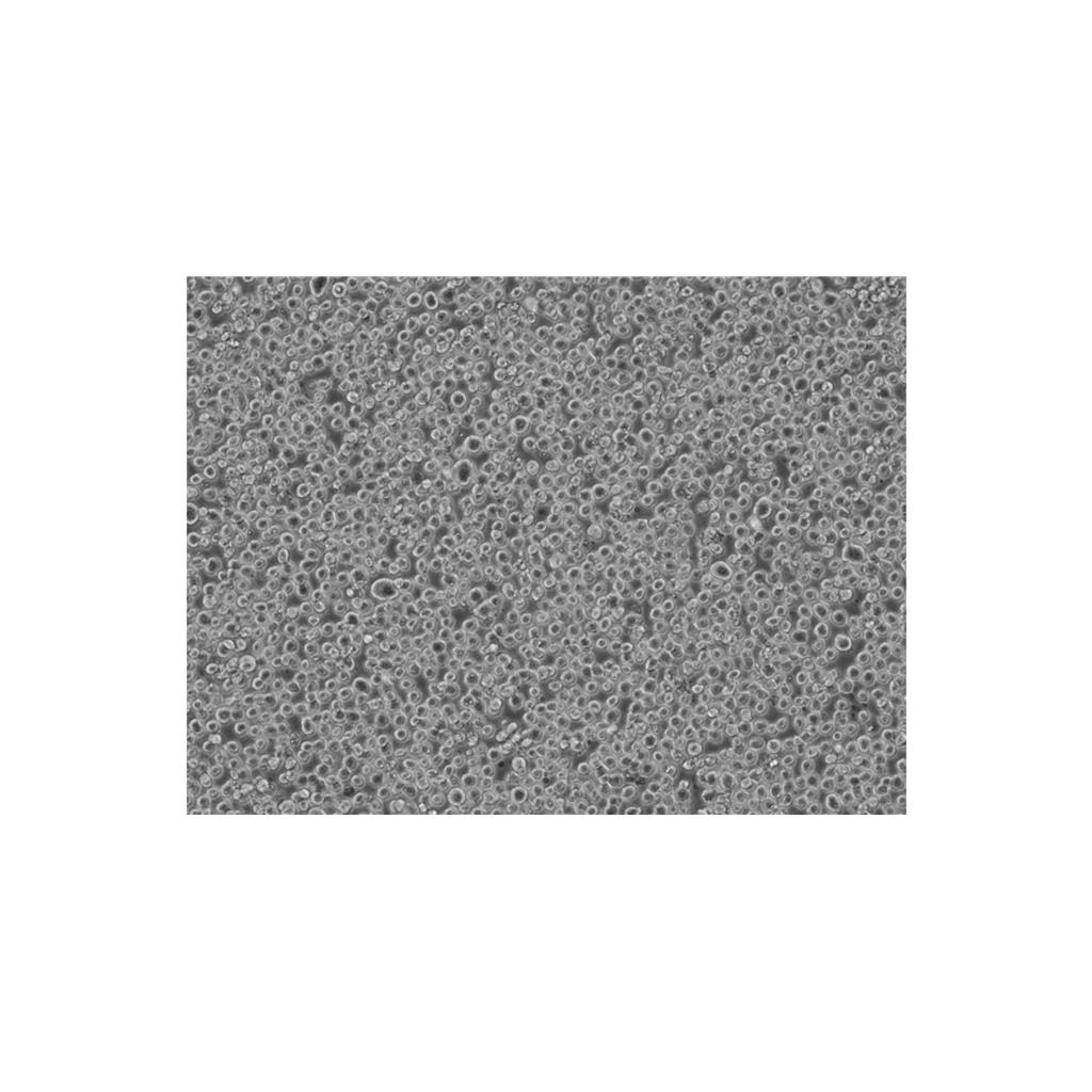 MA-891 Cells小鼠乳腺癌高转移细胞专业保种|STR图谱