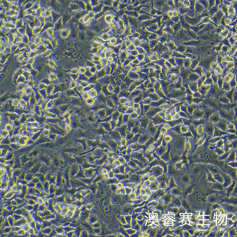 U373（人脑胶质瘤细胞）