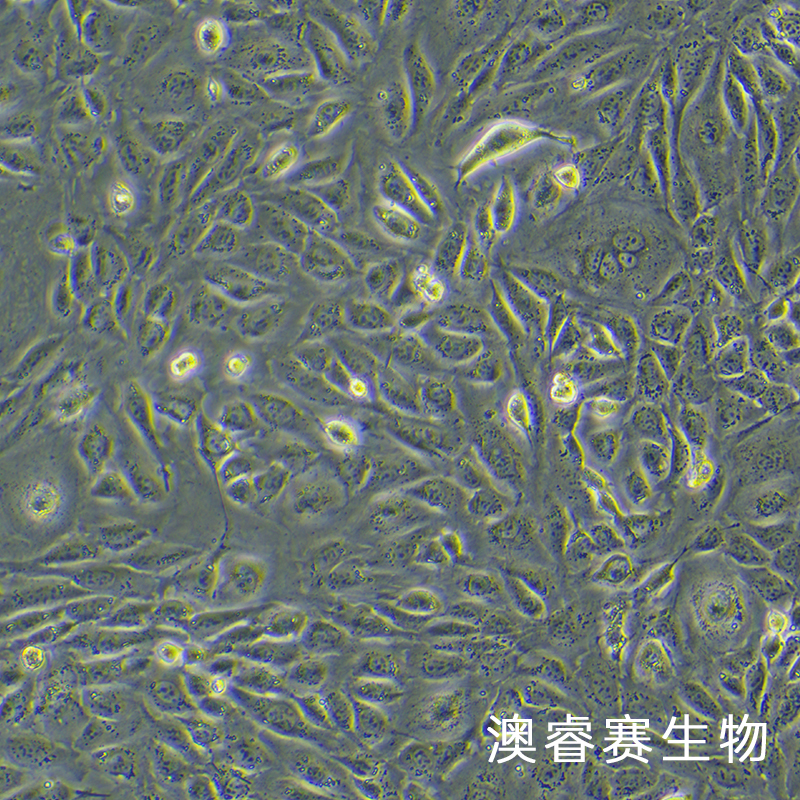 ID8（小鼠卵巢癌细胞）