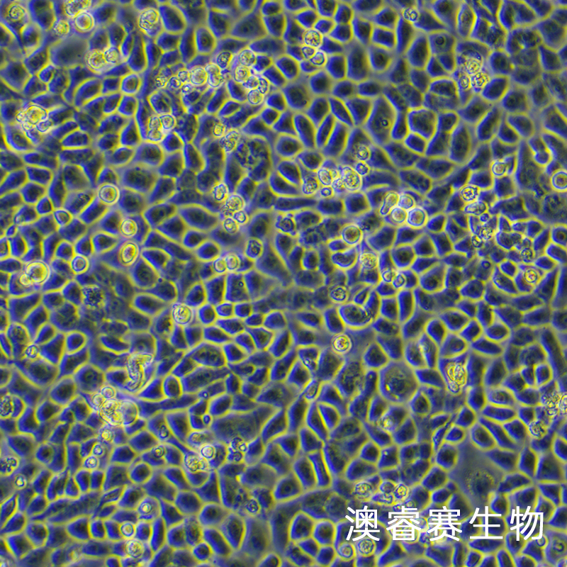 16HBE（人支气管上皮样细胞）