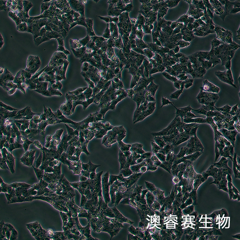 NCI-H295R [H295R] （人肾上腺皮质腺癌细胞）