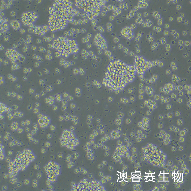 Jurkat（人急性T淋巴细胞白血病细胞）