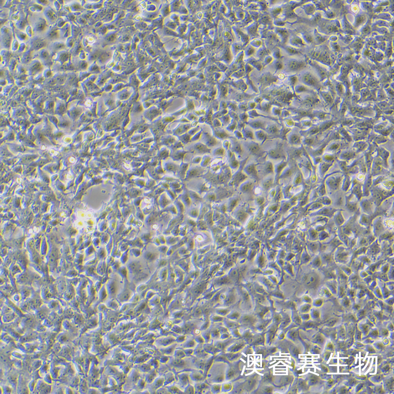 PA-1（人卵巢畸胎瘤细胞）