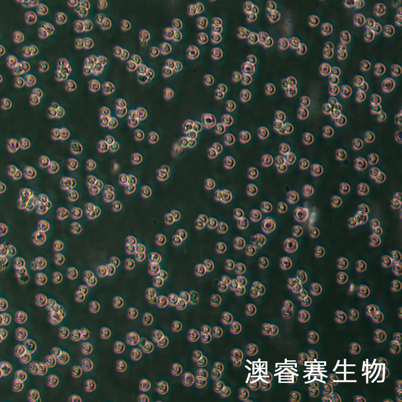 REC-1（人淋巴瘤细胞（B细胞非霍奇金淋巴瘤））