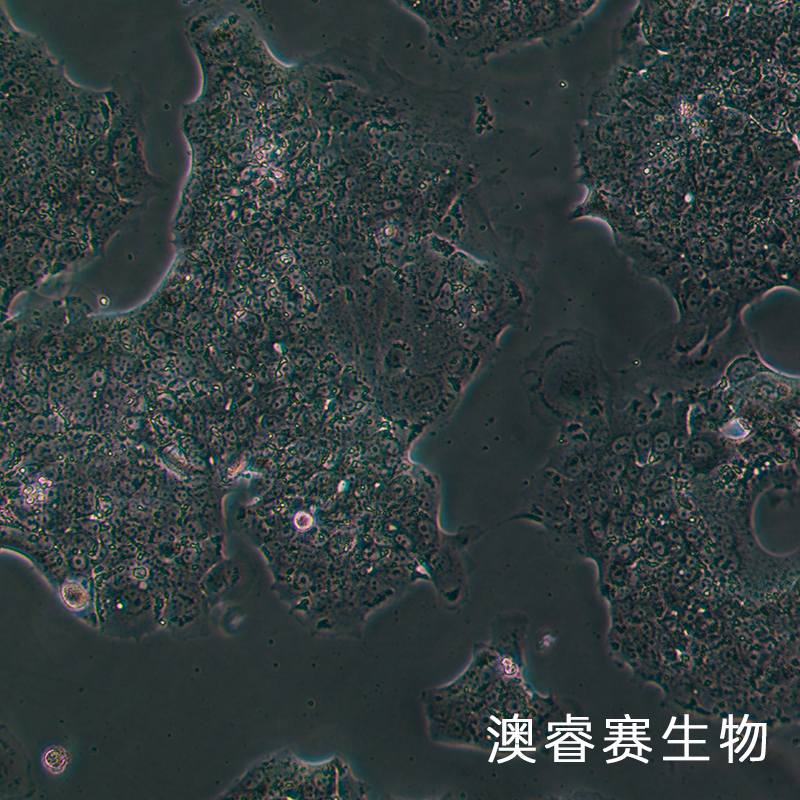 NCI-H2170（人肺鳞癌细胞）