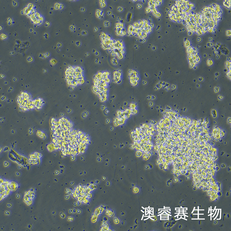 DMS-153（人小细胞肺癌）