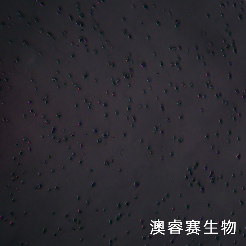 NCI-H69（人小细胞肺癌细胞）