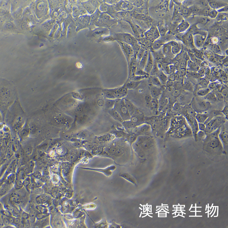 NCI-H1734（人非小细胞肺癌细胞）