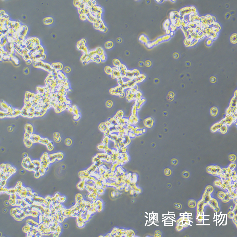 WERI-Rb-1（人视网膜母细胞瘤）