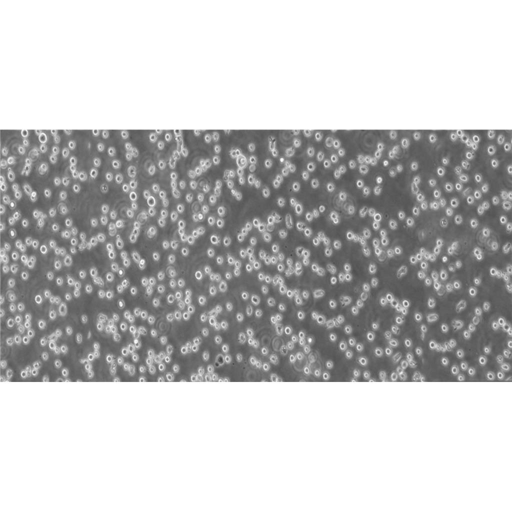 Ku812 Cells人外周血嗜碱性白血病细胞专业保种|STR图谱