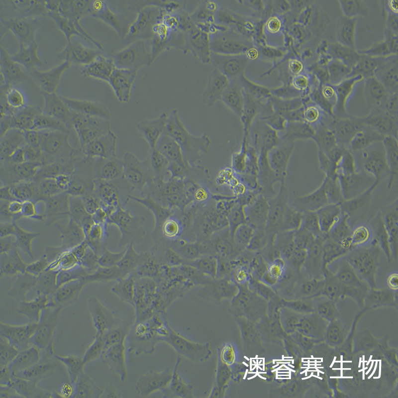 HCC38（人乳腺导管癌细胞）