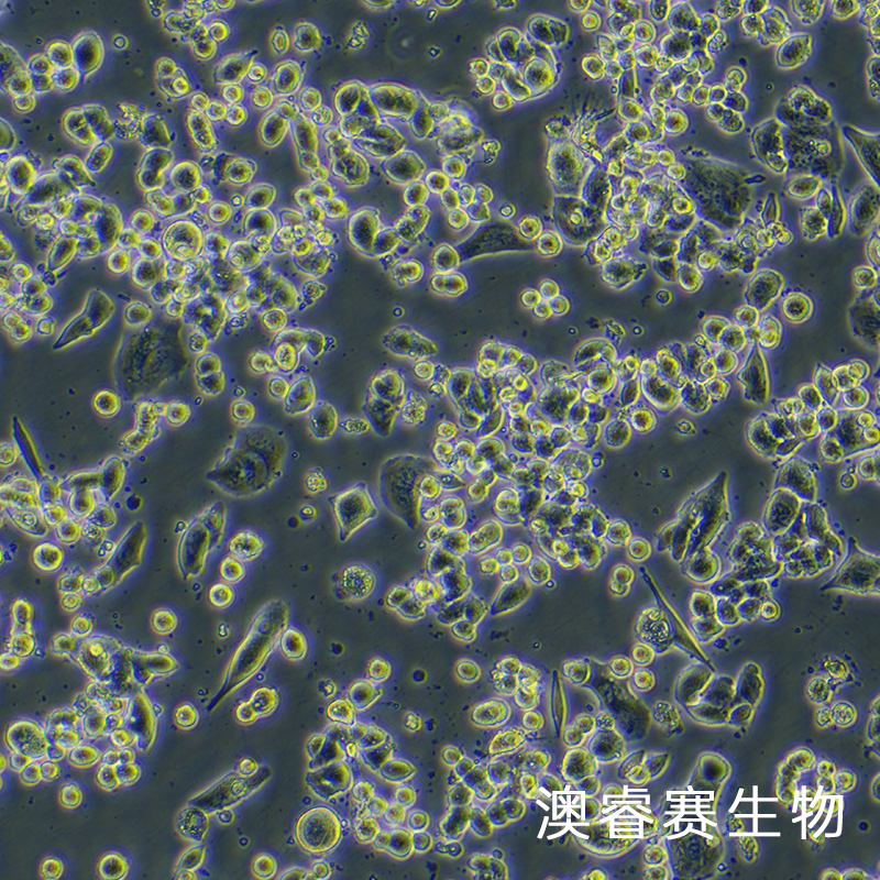 MDA-MB-134-VI（人乳腺导管癌细胞）