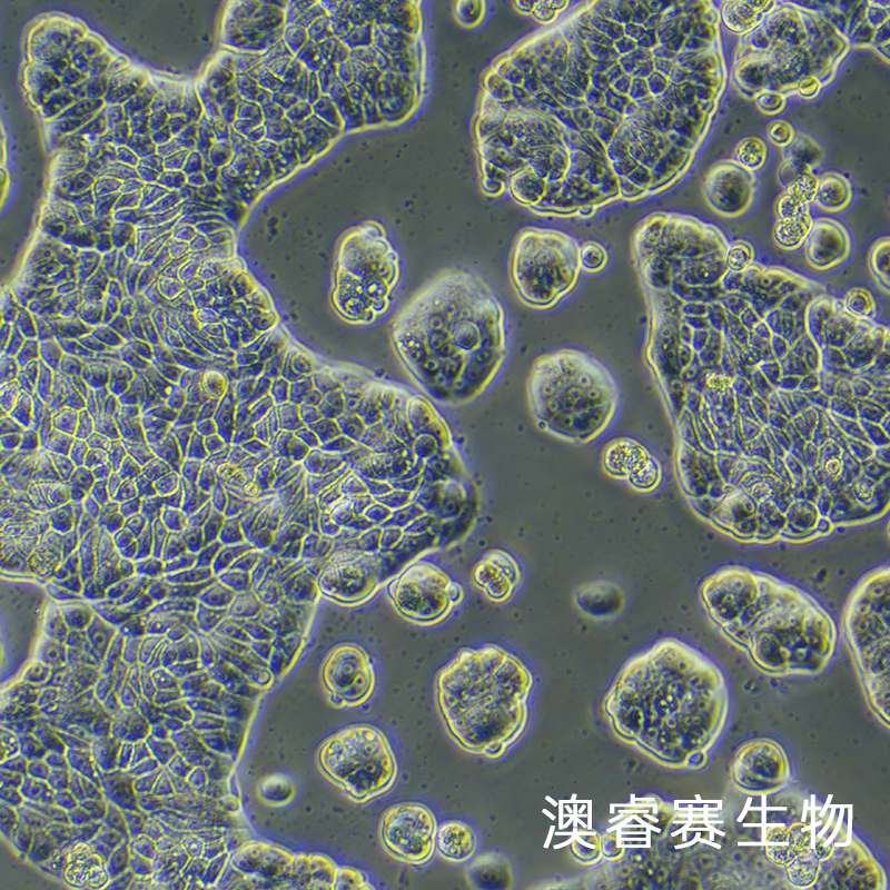 UACC-812（人乳腺导管瘤细胞）