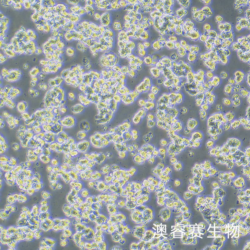 GH3（大鼠垂体瘤细胞）
