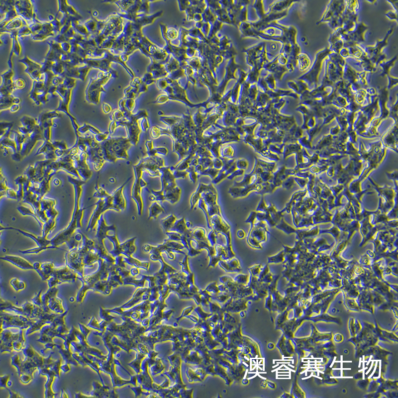 Min6（小鼠胰岛β细胞）