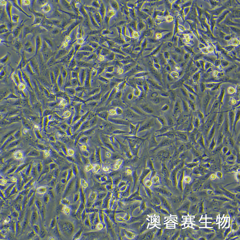 SV40-MES-13（小鼠肾小球系膜细胞）