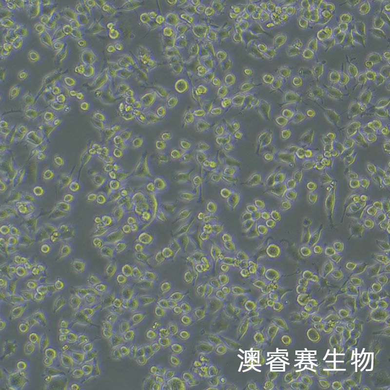 G422（小鼠脑神经胶质母细胞瘤瘤株）