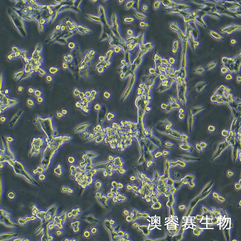 LLC（小鼠肺癌细胞）