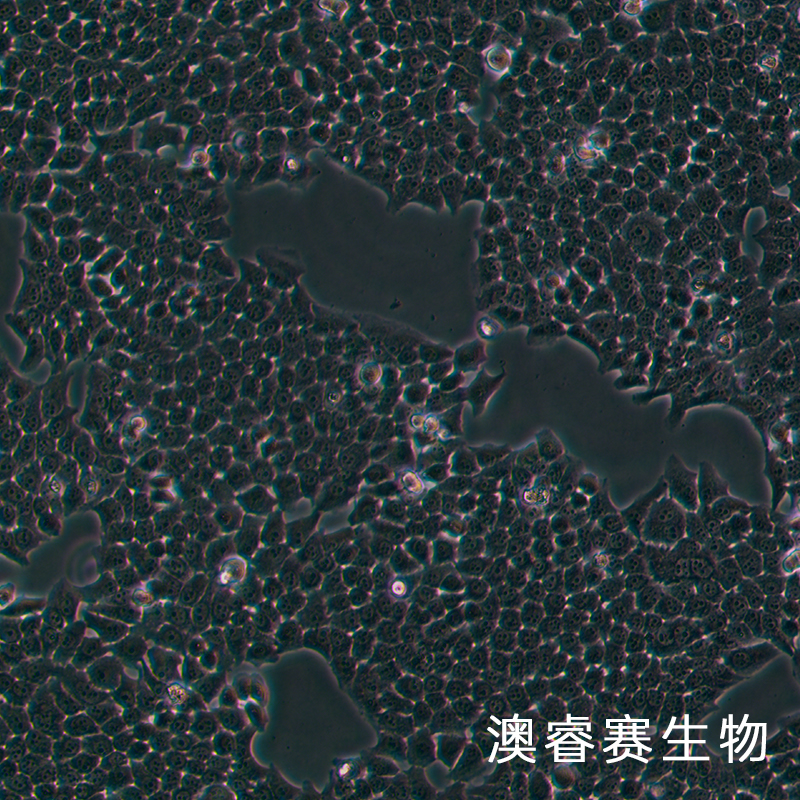 BGC-823（人胃腺癌细胞（低分化））