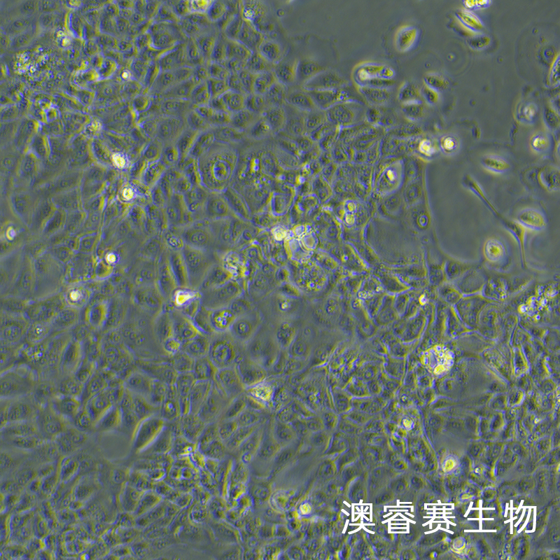 RWPE-1（人正常前列腺上皮细胞）
